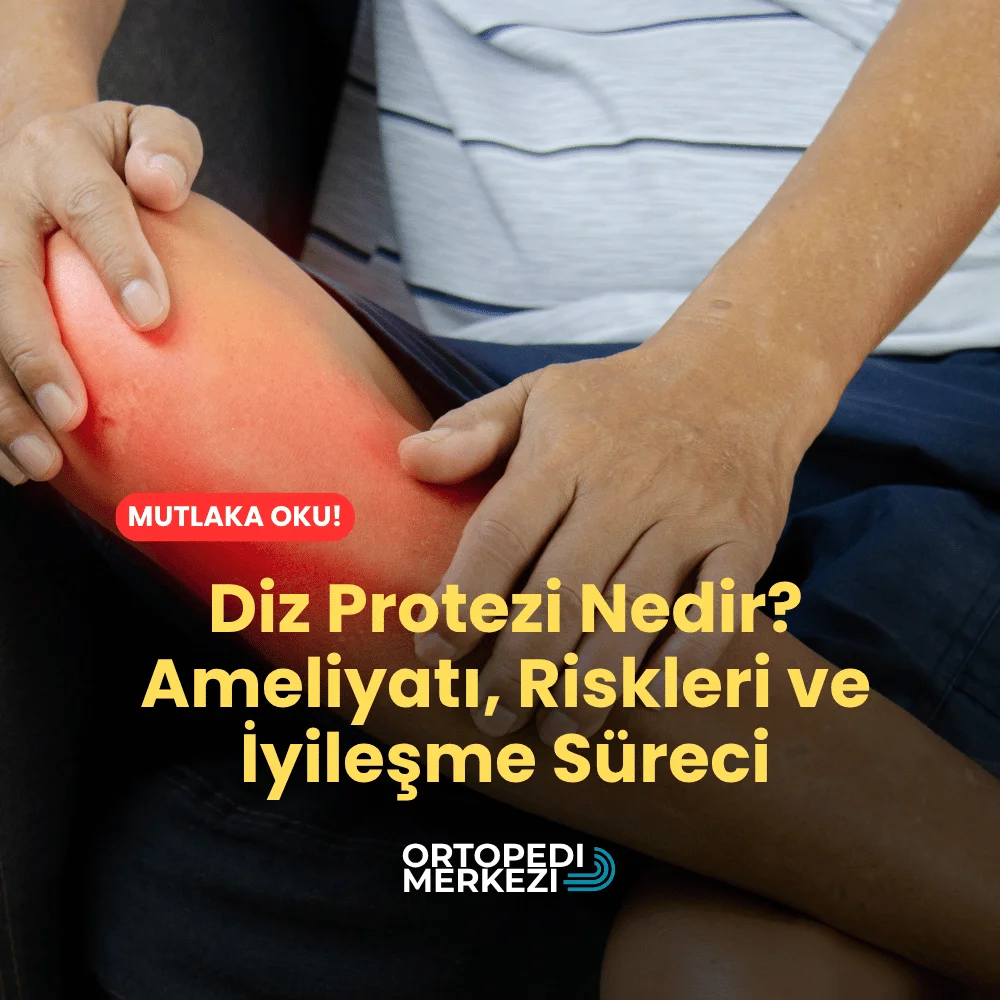 Diz Protezi Nedir? Ameliyatı, Riskleri ve İyileşme Süreci ne